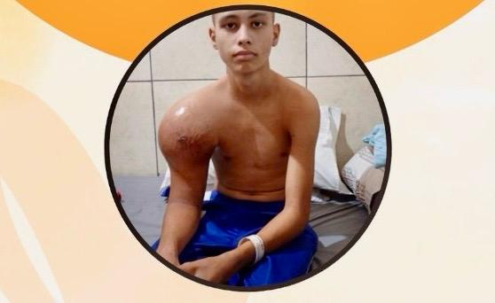 Jovem com câncer