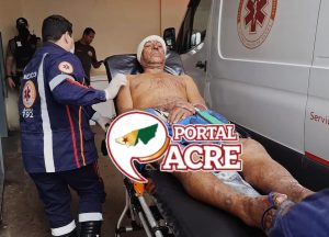 Golpe na cabeça