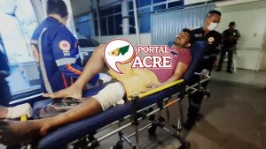 Homem é atingido na perna