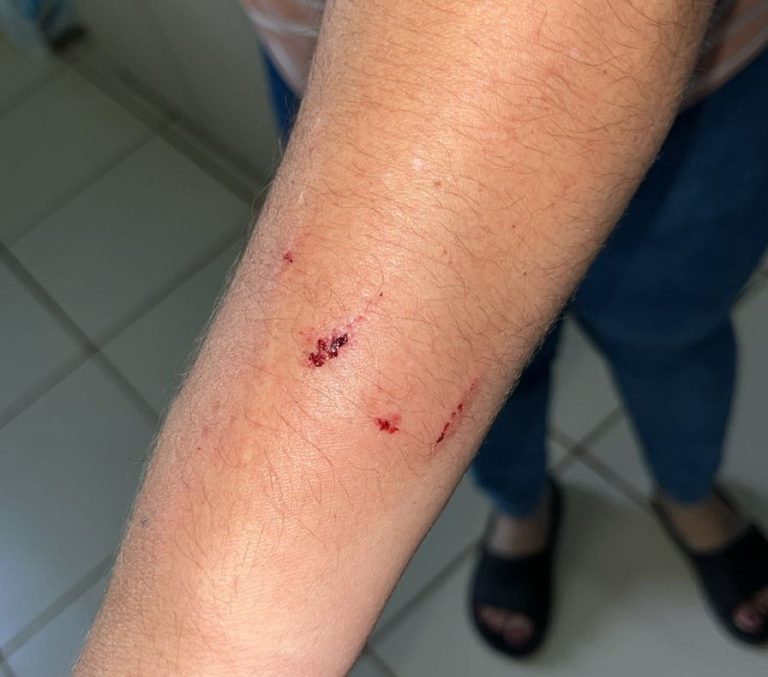 VÍDEO: segunda agressão em menos de um mês é registrada no Restaurante Popular de Rio Branco e funcionários cogitam greve