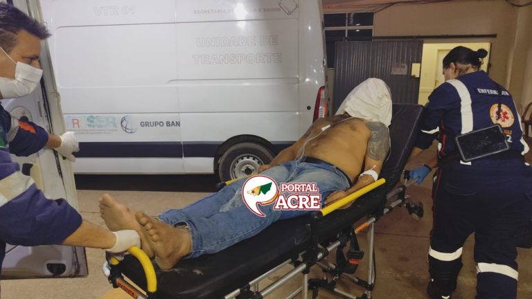 Espancado por grupo no bairro das Placas sofre fraturas nas costelas