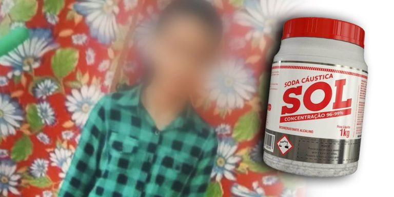 Criança de 11 anos permanece em estado grave após ingestão de soda cáustica e deve enfrentar série de cirurgias