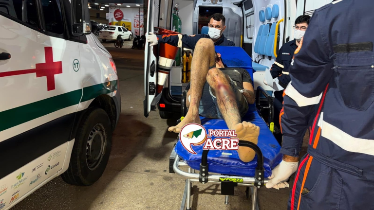 Homem fica em estado grave após ser agredido na região da Sobral