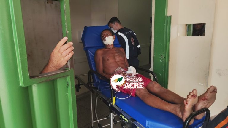 Morador é ferido com terçado na Cidade do Povo