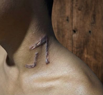 Adolescente de 13 anos é marcado no pescoço com ferro de marcar gado em Sena Madureira; Polícia Civil analisa